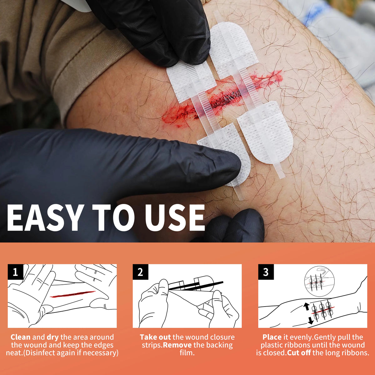 TrailRaiders™ Stitchless Wound Closure Kit